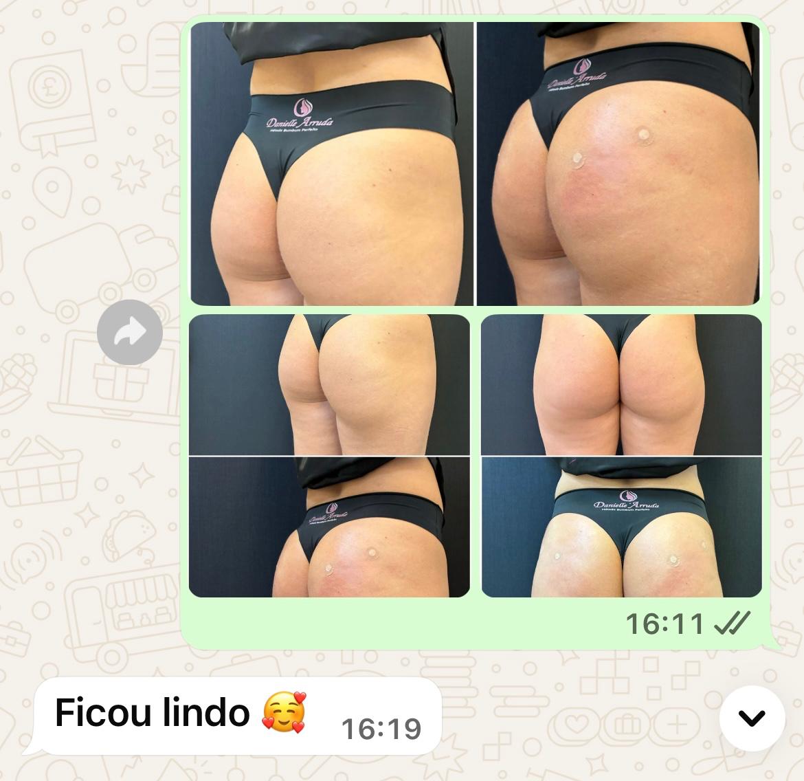Relato de paciente sobre a experiência com a clínica 5